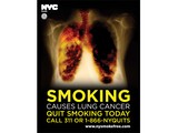 No Decaying Teeth or Lungs Allowed in Smoking Ads, Judge Rules