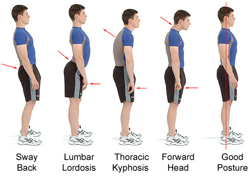 Spinal & Postural Screenings