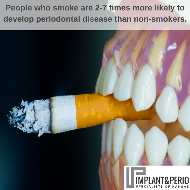 Did you know that people who smoke are 27 times more likely to develop