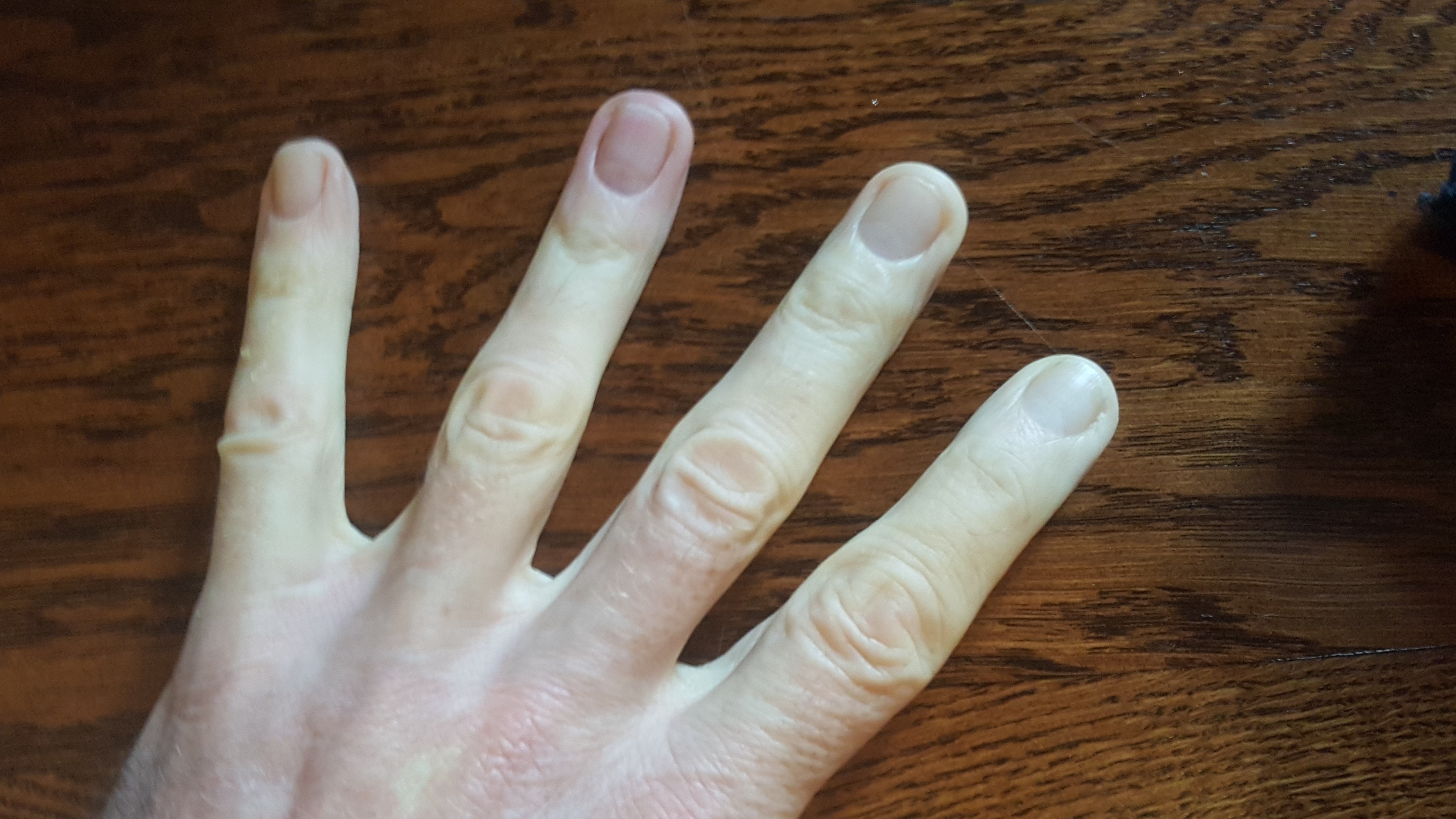 my hand trying to thaw out after the descent from the Tourmalet