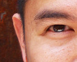 Nose_thumb