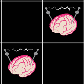 Electro Brain