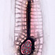 Suture-2002