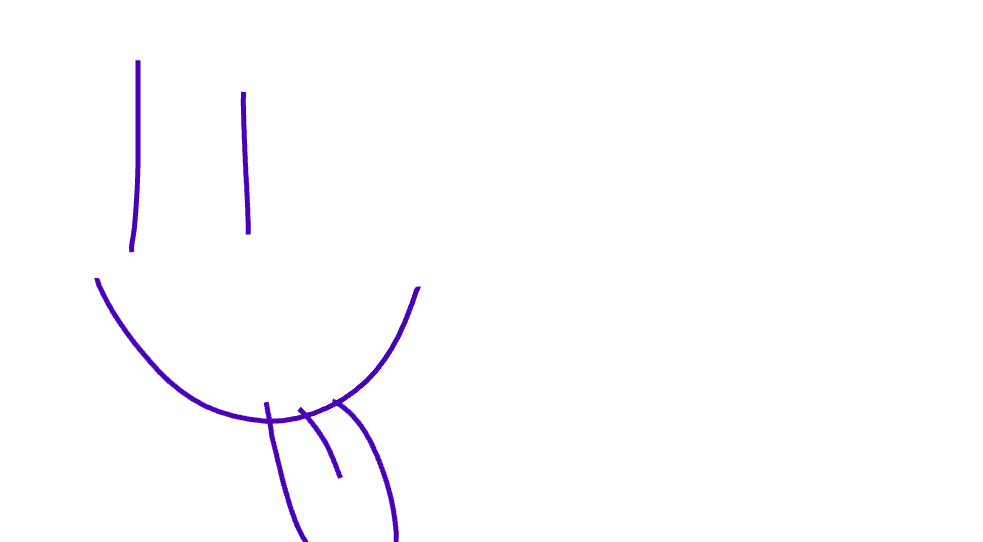 Unnamed