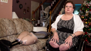 Connie Spears had to have both legs amputated above the knee, and blames an emergency room doctor for missing a critical diagnosis. The San Antonio woman's search for an attorney to take her case has been futile. 