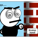 Broken hand