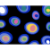Globules