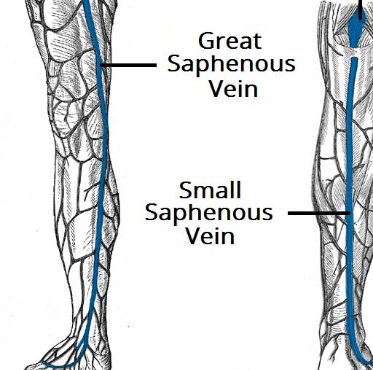 Peripheral Venous Examination - TeachMeSurgery diagram of hypernatremia 