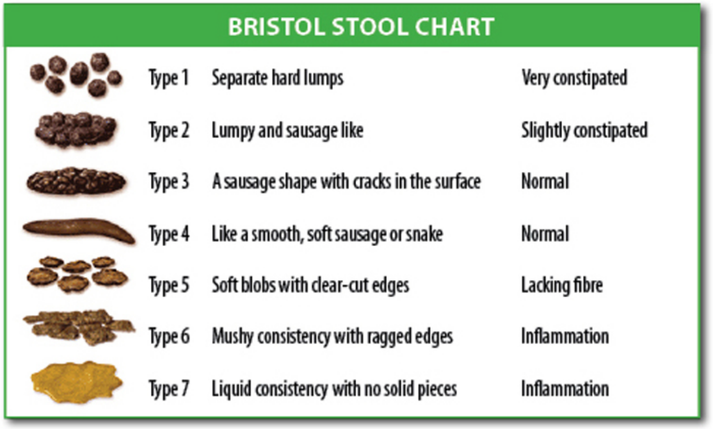 Fig 1 - The Bristol stool chart, used in the UK to monitor bowel habit.