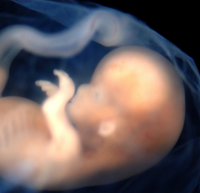 fetus, baby