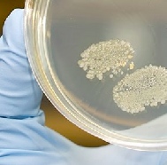 Bacteria