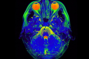 Why Neuromarketing's Time Hasn't Come