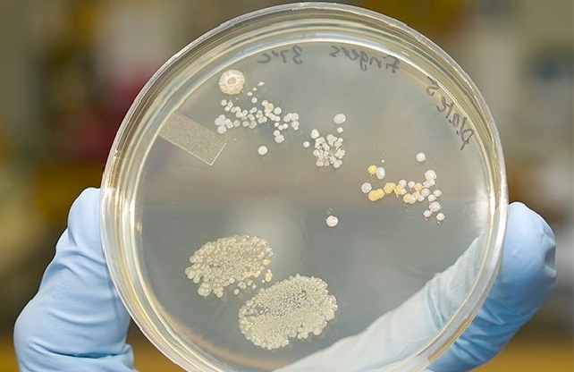 Bacteria