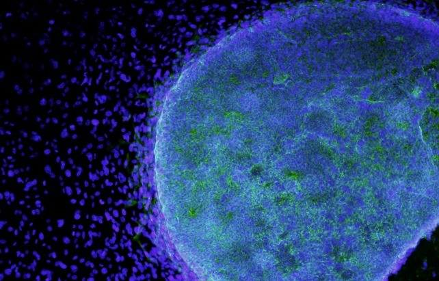 stem cells