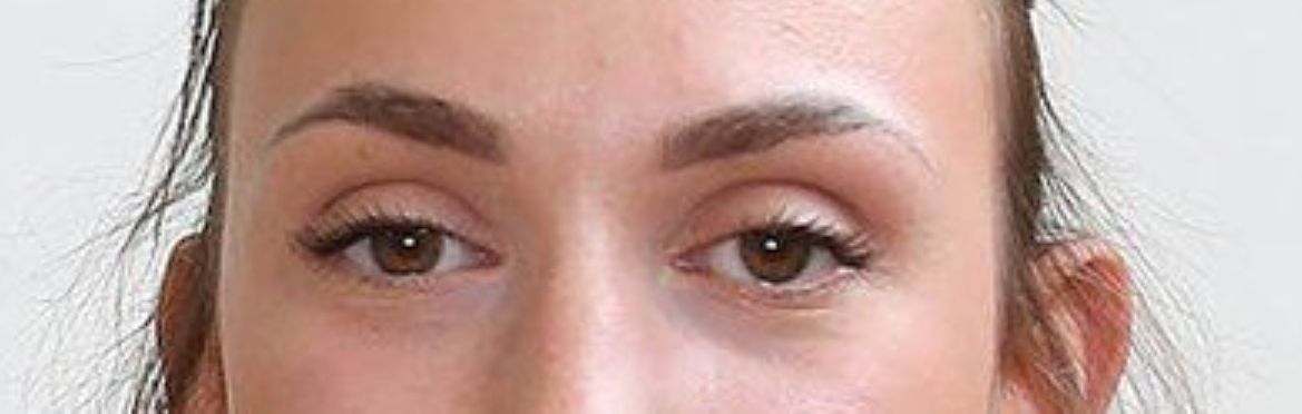 Serbia volleyball player banned: Now a racist ‘eye gesture’