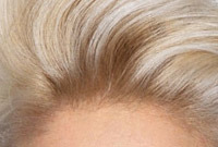Hair-care-tips-for-bleached-hair-side