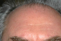 Hair-growth-problems-side