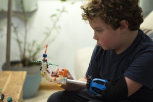 boy-3d-printed-prosthetic-hand-2 Posted in http://www.3ders.org/applications.html