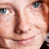 the-left-arm-test-that-accurately-predicts-skin-cancer-with-logo