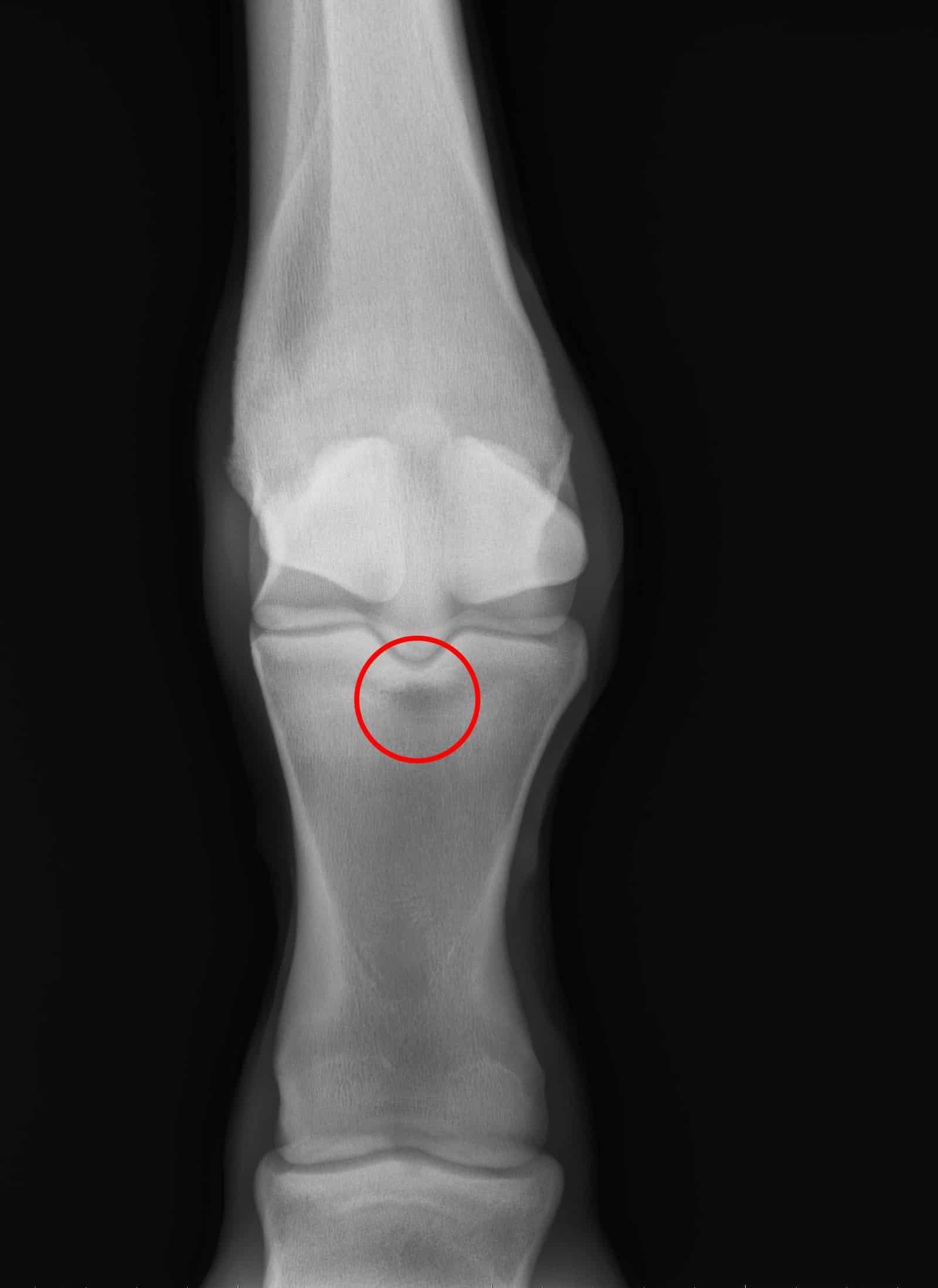 Pastern Lucencies