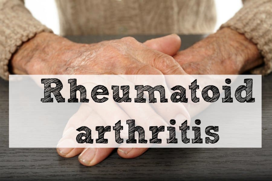 Rheumatoid arthritis Dr. John Bergman