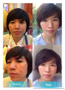 Feedback, đánh giá từ khách hàng đã Detox 437ac3ff928b6ad5339a