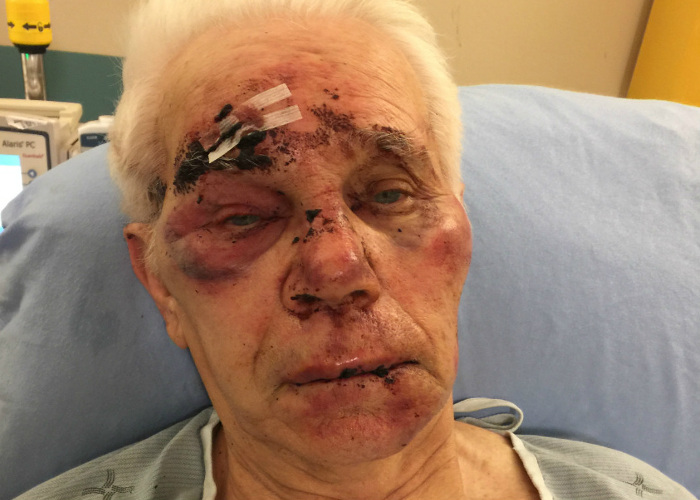 Family reaches out to CARP after father assaulted in long