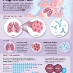 infografia prematuros