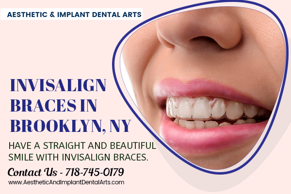 Invisalign Braces Brooklyn NY