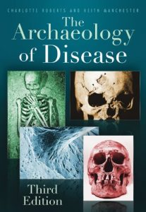 Descargar The Archaeology of Disease pdf, epub, ebook