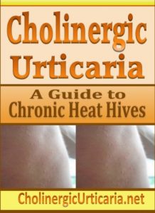 Descargar Cholinergic Urticaria: A Guide to Chronic Heat Hives (English Edition) pdf, epub, ebook