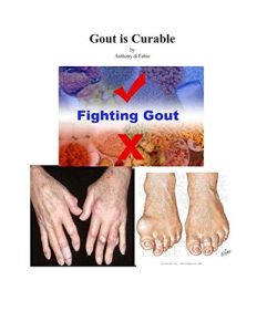 Descargar Gout is Curable (English Edition) pdf, epub, ebook