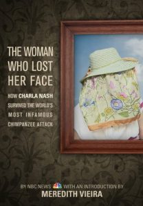 Download The Woman Who Lost Her Face: How Charla Nash Survived the World’s Most Infamous Chimpanzee Attack pdf, epub, ebook