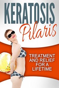 Download Keratosis Pilaris: Treatment and Relief (Health and Wellness) pdf, epub, ebook