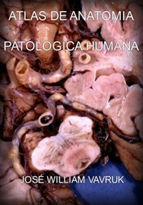 Download Atlas De Anatomia PatolÓgica Humana (Portuguese Edition) pdf, epub, ebook