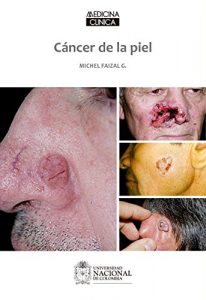 Download Cáncer de la piel (Spanish Edition) pdf, epub, ebook