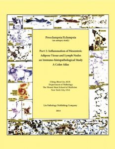 Download Preeclampsia/Eclampsia Part 2: Inflammation of Mesenteric Adipose Tissue and Lymph Nodes: An Immuno-histopathological Study pdf, epub, ebook