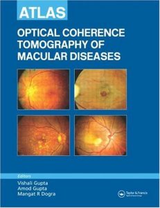 Download Atlas Optical Coherence Tomography of Macular Diseases pdf, epub, ebook