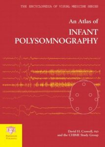 Download Atlas of Infant Polysomnography (Encyclopedia of Visual Medicine Series) pdf, epub, ebook