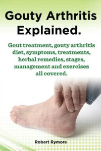 Download Gouty Arthritis explained. Gout treatment, gouty arthritis diet, symptoms, treatments, herbal remedies, stages, management and exercises all covered. pdf, epub, ebook