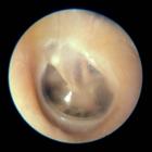 Otoscope Inspection