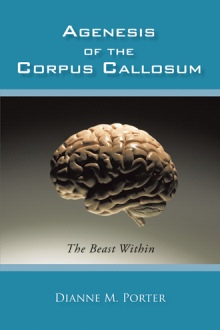 Agenesis of the Corpus Callosum