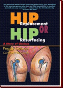 Hip Replacement or Hip Resurfacing