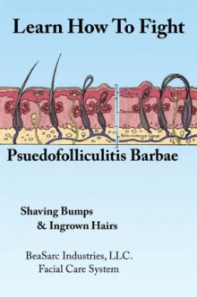 Learn How To Fight Psuedofolliculitis Barbae
