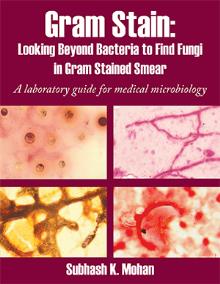 Gram Stain: Looking Beyond Bacteria to Find Fungi in Gram Stained Smear