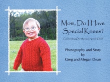 Mom, Do I Have Special Knees?