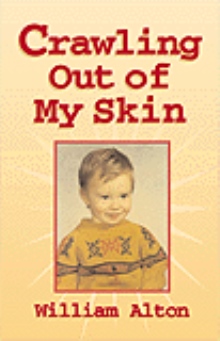 Crawling Out of My Skin