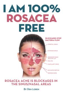 I Am 100% Rosacea Free