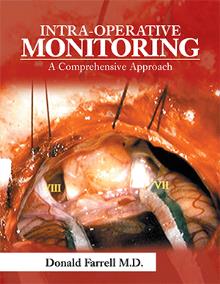 Intra-Operative Monitoring