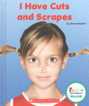 I Have Cuts and Scrapes
